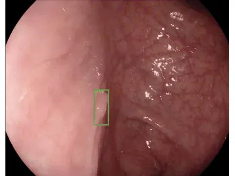 MedIA paper thumbnail