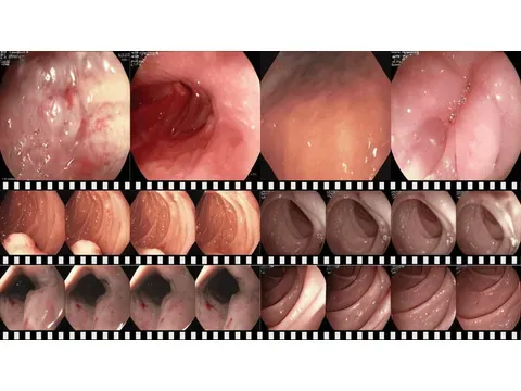 EndoGen paper thumbnail